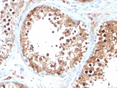 Immunohistochemistry-Paraffin: Inhibin alpha Antibody (INHA/4266) [NBP3-07458]