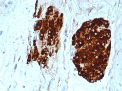 Immunohistochemistry-Paraffin: Inhibin alpha Antibody (INHA/6598R) - Azide and BSA Free [NBP3-08782]