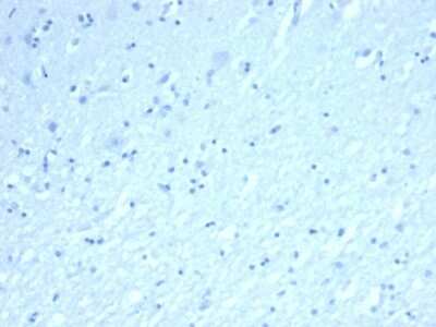 Immunohistochemistry-Paraffin: Inhibin alpha Antibody (INHA/6598R) - Azide and BSA Free [NBP3-08782]