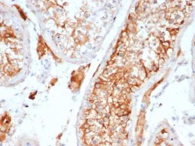 Immunohistochemistry-Paraffin: Inhibin alpha Antibody (INHA/6598R) - Azide and BSA Free [NBP3-08782]