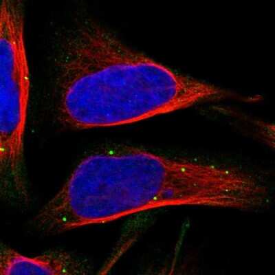 Immunocytochemistry/ Immunofluorescence: Inhibin alpha Antibody [NBP1-87563]