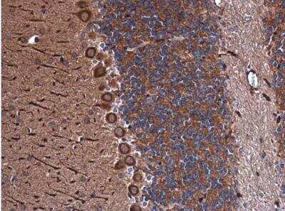 Immunohistochemistry-Paraffin: Inhibin alpha Antibody [NBP1-33030]