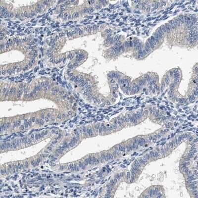 Immunohistochemistry-Paraffin: Inhibin alpha Antibody [NBP1-87563]