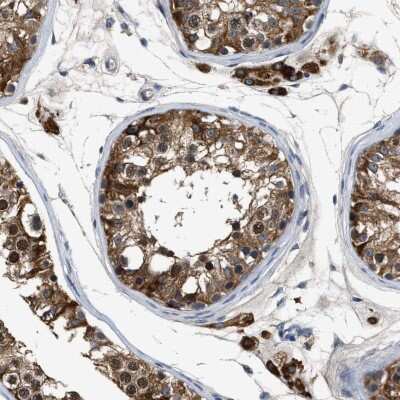 Immunohistochemistry-Paraffin: Inhibin alpha Antibody [NBP1-87563]