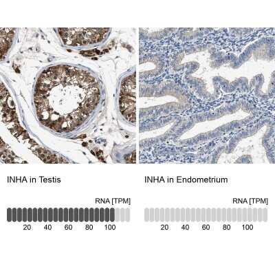 Immunohistochemistry-Paraffin: Inhibin alpha Antibody [NBP1-87563]