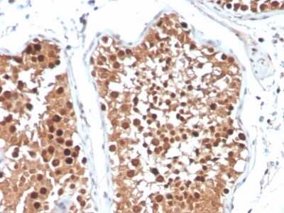 Immunohistochemistry-Paraffin: Inhibin alpha Antibody (R1) - Azide and BSA Free [NBP3-08781]