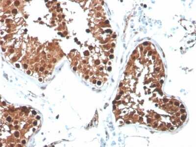Immunohistochemistry-Paraffin: Inhibin alpha Antibody (R1) - Azide and BSA Free [NBP3-08781]