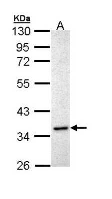 Western Blot: Inhibin alpha Antibody [NBP1-33030]