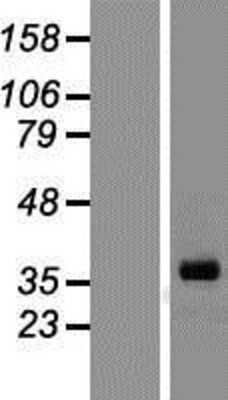 Western Blot: Inhibin alpha Overexpression Lysate [NBP2-10811]