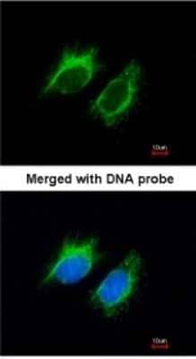 Immunocytochemistry/ Immunofluorescence: Activin A Antibody [NBP1-30928]