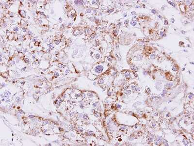 Immunohistochemistry-Paraffin: Activin A Antibody [NBP1-30928]