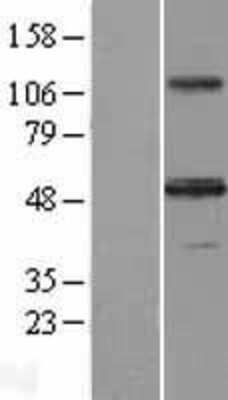 Western Blot: Activin A Overexpression Lysate [NBL1-11994]