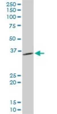 Western Blot: Inorganic Pyrophosphatase/PPA1 Antibody (3B2) [H00005464-M01]