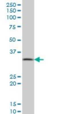 Western Blot: Inorganic Pyrophosphatase/PPA1 Antibody (3B2) [H00005464-M01]