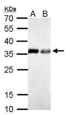 Western Blot: Inorganic Pyrophosphatase/PPA1 Antibody [NBP1-31348]