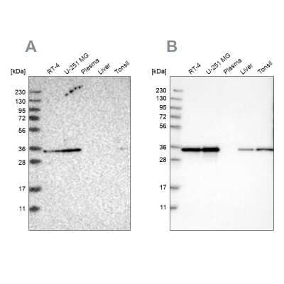 Western Blot: Inorganic Pyrophosphatase/PPA1 Antibody [NBP1-87787]