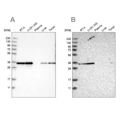 Western Blot: Inorganic Pyrophosphatase/PPA1 Antibody [NBP1-87788]