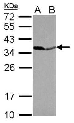 Western Blot: Inorganic Pyrophosphatase/PPA1 Antibody [NBP2-20021]