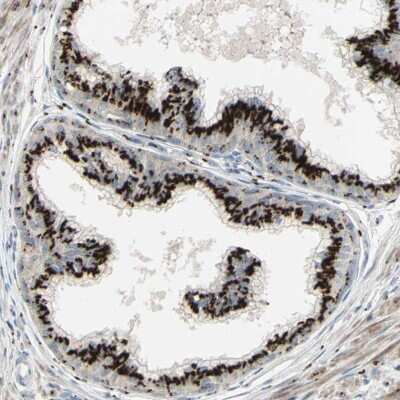 Immunohistochemistry-Paraffin: Inositol Monophosphatase 3/IMPAD1 Antibody [NBP1-83655]
