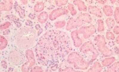 Immunohistochemistry-Paraffin: Insulin R/CD220 Antibody - BSA Free [NB110-55539]