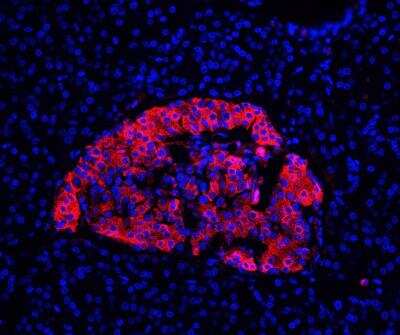 Immunohistochemistry-Paraffin: Insulin Antibody (E2-E3 + 2D11-H5 (same as INS04 + INS05)) [NBP2-34261]