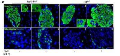 Immunohistochemistry: Insulin Antibody (E2-E3 (same as INS04)) [NBP2-34260]