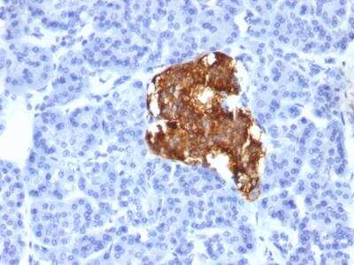 Immunohistochemistry-Paraffin: Insulin Antibody (IRDN/805) - IHC-Prediluted [NBP2-48273]