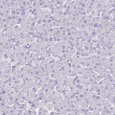 Immunohistochemistry-Paraffin: Insulin Antibody [NBP1-87485]