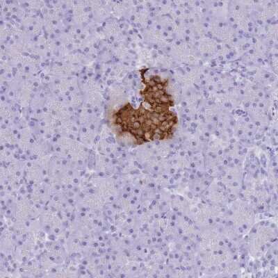 Immunohistochemistry-Paraffin: Insulin Antibody [NBP1-87485]