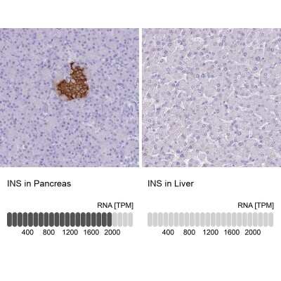 Immunohistochemistry-Paraffin: Insulin Antibody [NBP1-87485]