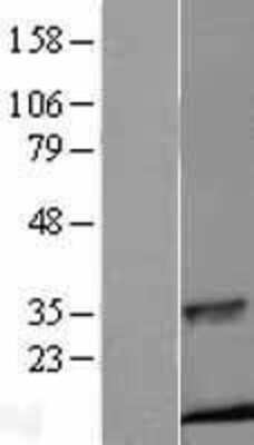 Western Blot: Insulin Overexpression Lysate [NBL1-12002]