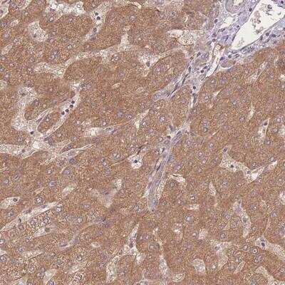 Immunohistochemistry-Paraffin: Insulin R/CD220 Antibody [NBP2-14124]