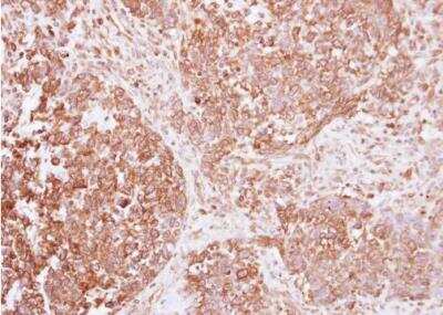 Immunohistochemistry-Paraffin: Insulin R/CD220 Antibody [NBP2-16970]