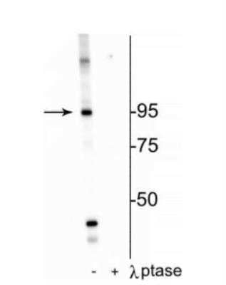 Western Blot: Insulin Receptor beta [p Thr1160] Antibody [NBP2-60777]