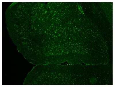 Immunohistochemistry-Paraffin: Insulin Receptor beta Antibody [NBP2-12793]