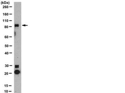 Western Blot: Insulin Receptor beta Antibody [NB120-10991]