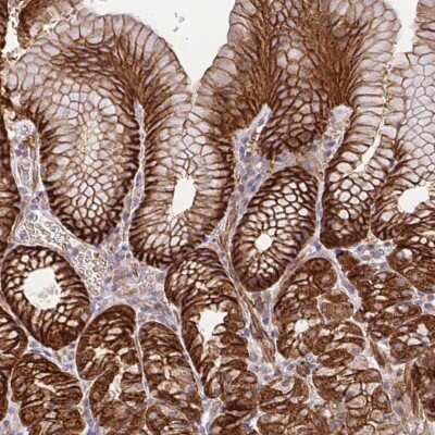 Immunohistochemistry-Paraffin: Insulysin/IDE Antibody [NBP2-38994]