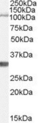 Western Blot: Insulysin/IDE Antibody [NB100-61667]