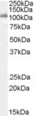 Western Blot: Insulysin/IDE Antibody [NB100-68148]