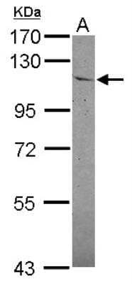 Western Blot: Insulysin/IDE Antibody [NBP2-16914]
