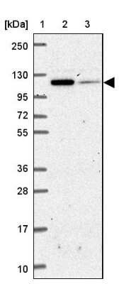 Western Blot: Insulysin/IDE Antibody [NBP2-38994]