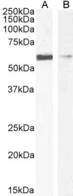 Western Blot: Insulysin/IDE Antibody [NBP2-75092]