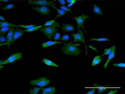 Immunocytochemistry/ Immunofluorescence: Integrin alpha 1/CD49a Antibody (4G11) [H00003672-M02]