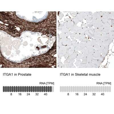 Immunohistochemistry-Paraffin: Integrin alpha 1/CD49a Antibody (CL7207) [NBP2-76478]