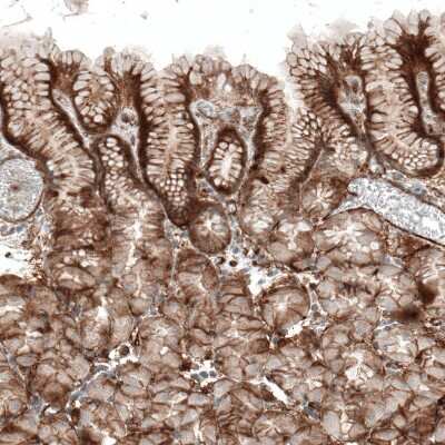 Immunohistochemistry-Paraffin: Integrin alpha 1/CD49a Antibody (CL7207) [NBP2-76478]