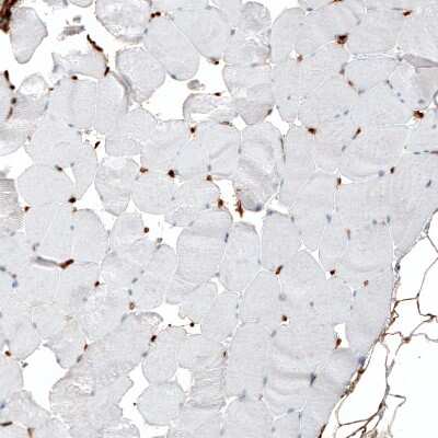 Immunohistochemistry-Paraffin: Integrin alpha 1/CD49a Antibody (CL7207) [NBP2-76478]