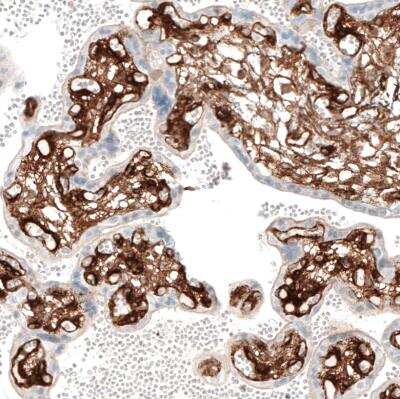 Immunohistochemistry-Paraffin: Integrin alpha 1/CD49a Antibody (CL7207) [NBP2-76478]
