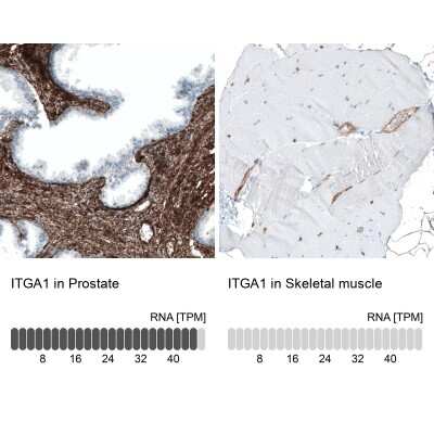 Immunohistochemistry-Paraffin: Integrin alpha 1/CD49a Antibody (CL7217) [NBP2-76479]