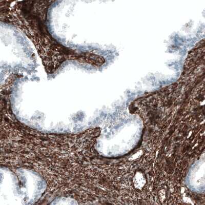 Immunohistochemistry-Paraffin: Integrin alpha 1/CD49a Antibody (CL7217) [NBP2-76479]