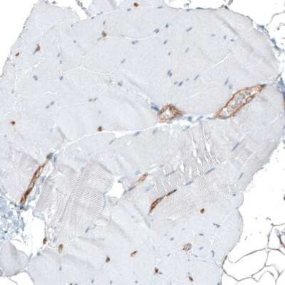 Immunohistochemistry-Paraffin: Integrin alpha 1/CD49a Antibody (CL7217) [NBP2-76479]